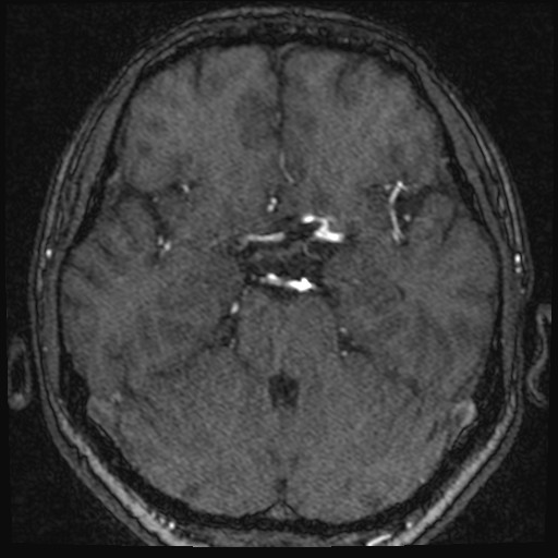 Click on the Serie image to view the images of VILLANUEVA, WILLIAM A.